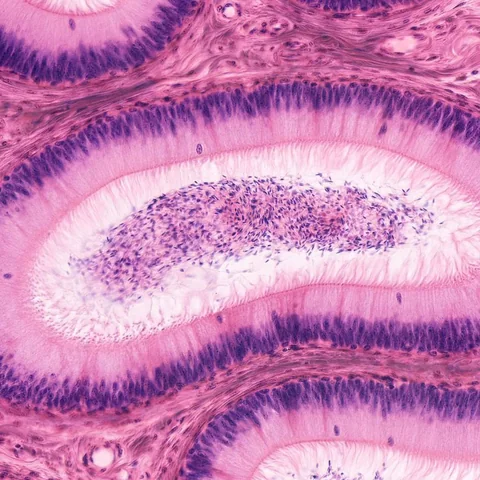 Micrograph of the epididymis, H&E, x400, showing stereocilia